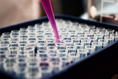 Uzmanlık Alanları diagnostic lab case gallery 3